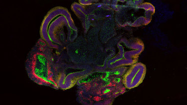 A 34-day-old brain organoid section.