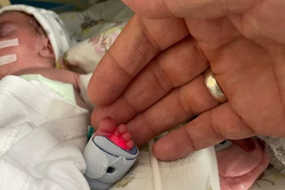 Baby Alba was born 10 weeks early and weighed just 1.3 kilograms.