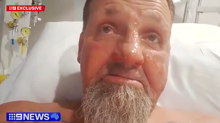 smh.com.au - Daniel Lo Surdo - Patient suffers burns in alleged petrol attack inside major Sydney hospital