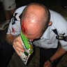 The policeman hurt in the Boronia fracas.