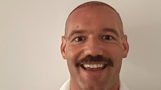 Jamie Lampard, a Victorian real estate agent who recently got a hair transplant, says it’s already helping his career.