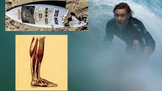 Surfer Kai McKenzie lost his leg to a shark bite.