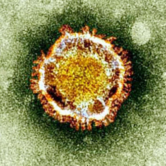 The Coronavirus seen under an electron miscroscope.