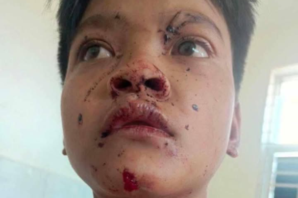 Saly shortly after the explosion.