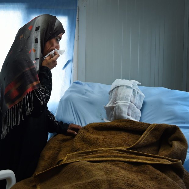 Sana Abdul Amir tends to her son Abdulrahman Abdulaaly, 18, who was being treated for burns to 60 per cent of his body in June 2017. He died days later.