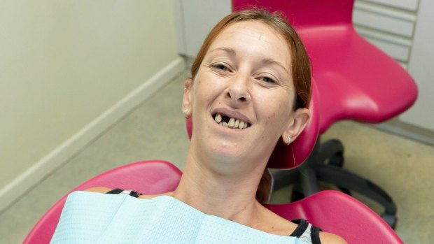 Natalie Pearn before she got her new dental bridge.