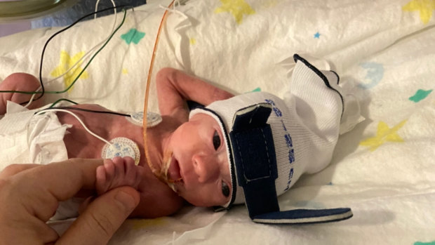 Newborn Ellie weighed 789 grams at birth.