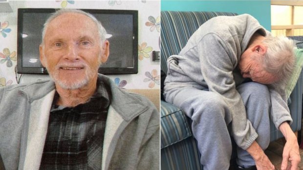 Terry Reeves, left, before he went into aged care, and right, an image published on ABC's 7.30 showed how his health deteriorated in care. 