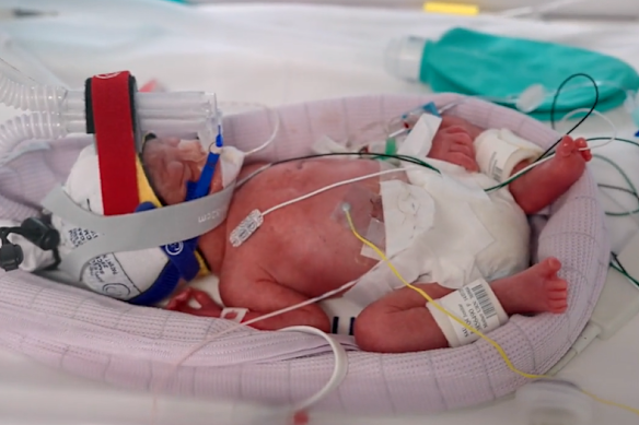 Four girls (Emily, Harriet, Alexa and Catherine) were born by caesarean section.