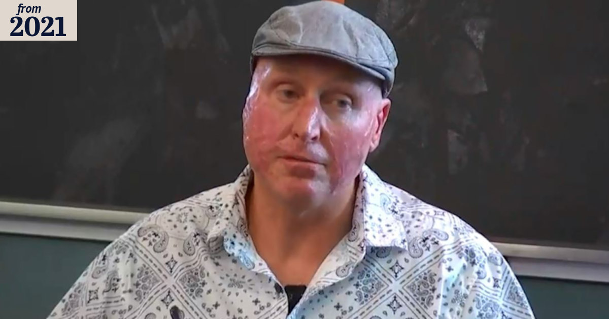 Queensland miner didn’t realise he was still on fire after mine explosion