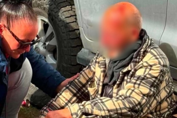 The man, 72, has been treated for injuries to his ribs but will require facial surgery.