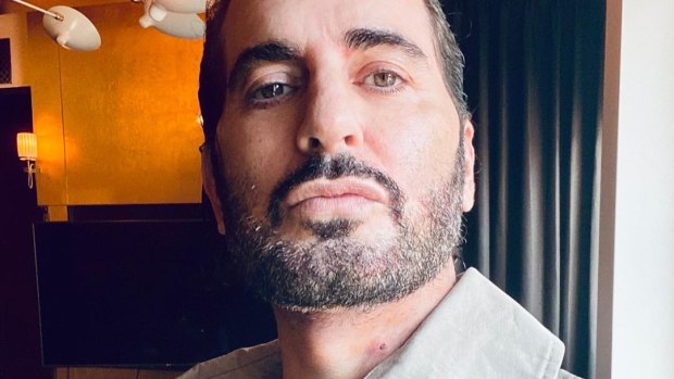 As Marc Jacobs admits to a facelift, is it better to be honest about cosmetic surgery?