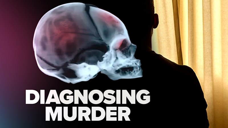 Legal reversals and landmark US decision won’t change shaken baby prosecutions