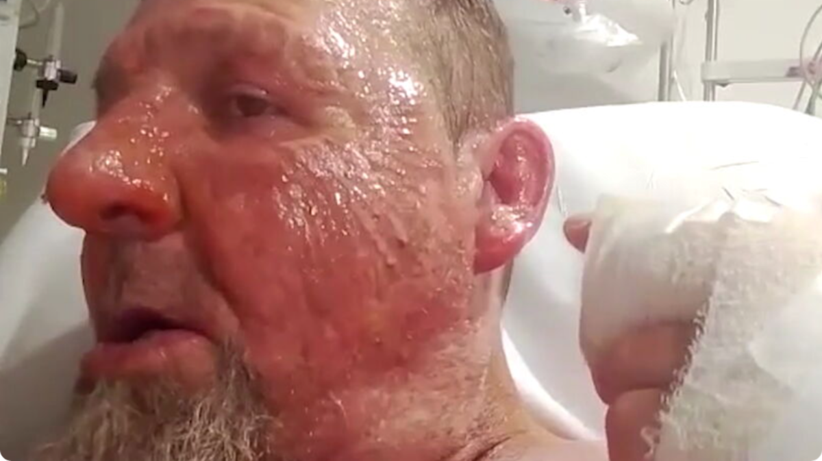 Patient suffers horror burns in terrifying petrol attack inside major hospital