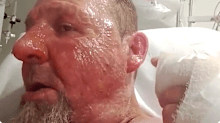 Randovan Banic, who was left with serious burns following an alleged petrol attack inside Prince of Wales Hospital.