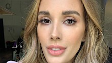 Bec Judd once got botched filler that left her looking like “an alien,” the Aussie influencer revealed. 