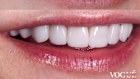 Before and after shots of Laura Gregory's teeth. 