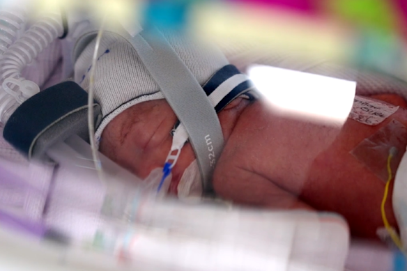 Healthy identical quadruplets were born at 28 weeks and four days.