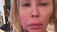 The 53-year-old has spent years battling debilitating health problems that have left her face visibly disfigured.