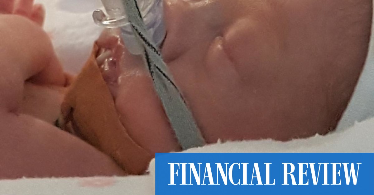 The world's first artificial womb is on the way - Vimarsana News