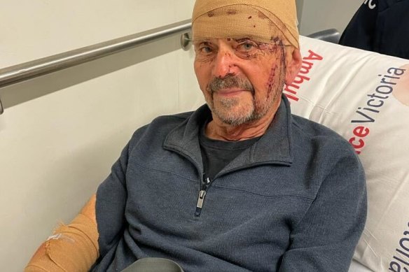 Guy Ward in Box Hill Hospital immediately after a dog attacked him in Nunawading.