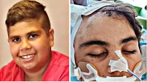 Cassius Turvey, before and after the alleged attack.