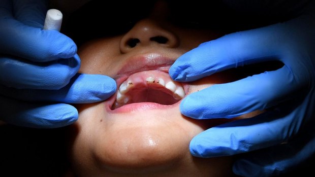 Waiting times to be treated in the public dental service can be nearly two years.