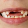 We need to face the rotten truth about our children's teeth