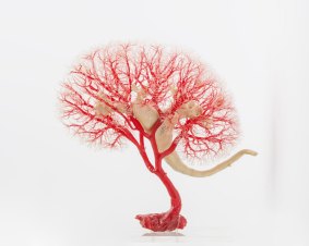 J Carney Corrosion resin cast of the kidney blood vessels, 1968, from the Harry Brookes Allen Museum of Anatomy and Pathology, the University of Melbourne.