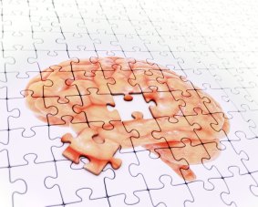 Researchers are learning more about the importance of cognitive health.
