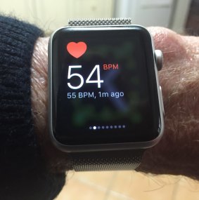 Garry Barker's life-saving Apple Watch.