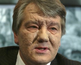 The face of Ukrainian leader Viktor Yushchenko, shows the scars of an alleged poisoning.