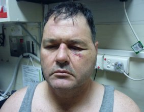 Bad day: Broken Hill Prison Officer Jason Gould's eye was damaged when an inmate threw a pool ball.