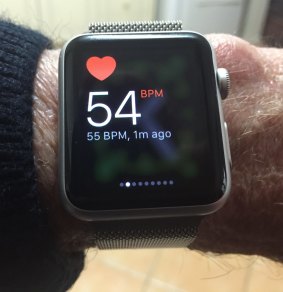 The lifesaving Apple Watch.