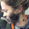 The woman was badly burnt when her headphones exploded on a flight from Beijing to Melbourne.