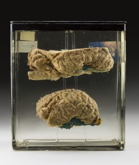 A horse brain from the Australian Institute of Anatomy's specimen collection, dated 1933.