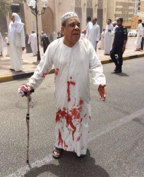 A man in a blood-soaked dishdasha after the attack.