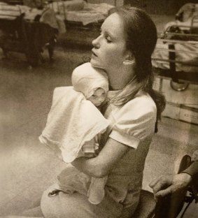 In this photo taken at Albany Medical Centre in 1977, nurse Susan Berger cuddles Amanda Scarpinati, who had been severely burnt by a steam vaporiser at home.