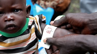 Nyatut was identified as being severely malnourished at The Save the Children feeding centre in Denjuok, South Sudan, last year. Reducing poverty and hunger was a major aim of the Millennium Development Goals.