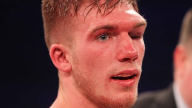 In coma: Nick Blackwell after being defeated by Chris Eubank Jnr.
 .