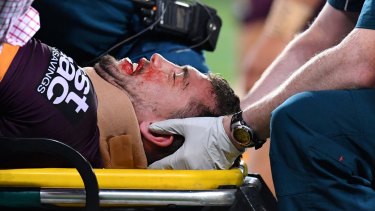 Knock out: Corey Oates leaves the field on a stretcher last Friday night.