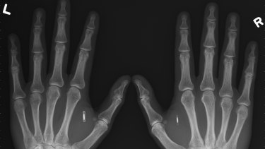 Three Square Market is offering all its employees the option to get a microchip implanted between the thumb and forefinger. 