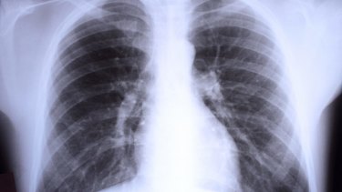 Doctors have been urged to stop ordering routine chest x-rays for children with respiratory and abdominal symptoms.