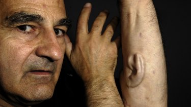 Stelarc with an ear implanted on his arm as part of his 2007 project Alternate Anatomical Architectures.