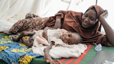 Amina, 8, weighs 7.2kg. She suffers from severe acute malnutrition accompanied by severe diarrhea and has chronic cerebral palsy. Pictured with her mother, Amina, Amina is being fed at MSF's Gwange therapeutic feeding centre.