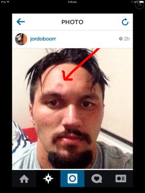 Jordan Rapana's Instagram account showing his head injury.
