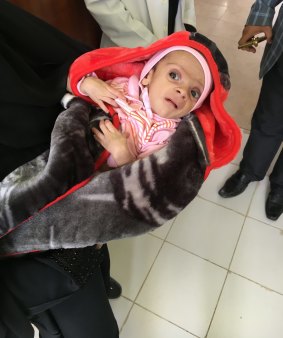 This is Abdulrhaman, a two month old baby in one of IMC's facilities, who this weekend weighed 3 kilograms. Severe malnutrition and dehydration from diarrhea.