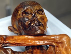 The 5300-year-old mummy known as Otzi the Iceman. 