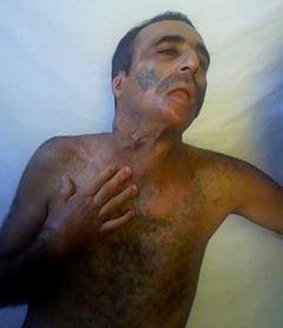 Majid Karami Kamasaei shows his scars, 