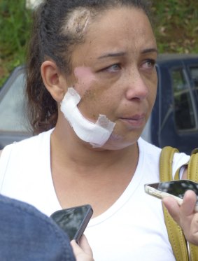Local resident Priscila Monteiro Isabels was injured in the disaster. 